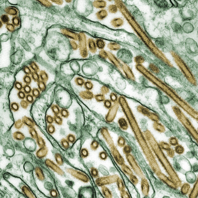 Digitally-colorized transmission electron microscopic image of Avian Influenza A H5N1 virus particles (seen in gold), grown in Madin-Darby Canine Kidney (MDCK) epithelial cells (seen in green). -- infectious disease coverage from STAT