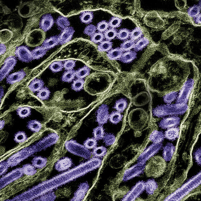 Avian Influenza A Virus colorized in purple in a green environment — health coverage from STAT