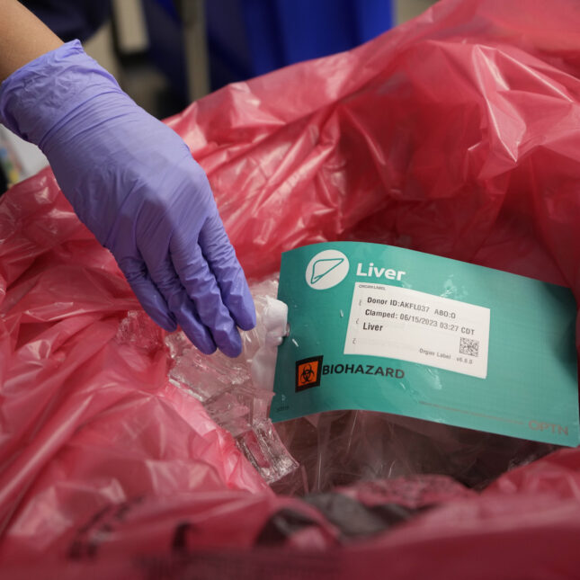 A news photograph of a donor liver nestled in ice in a transport container